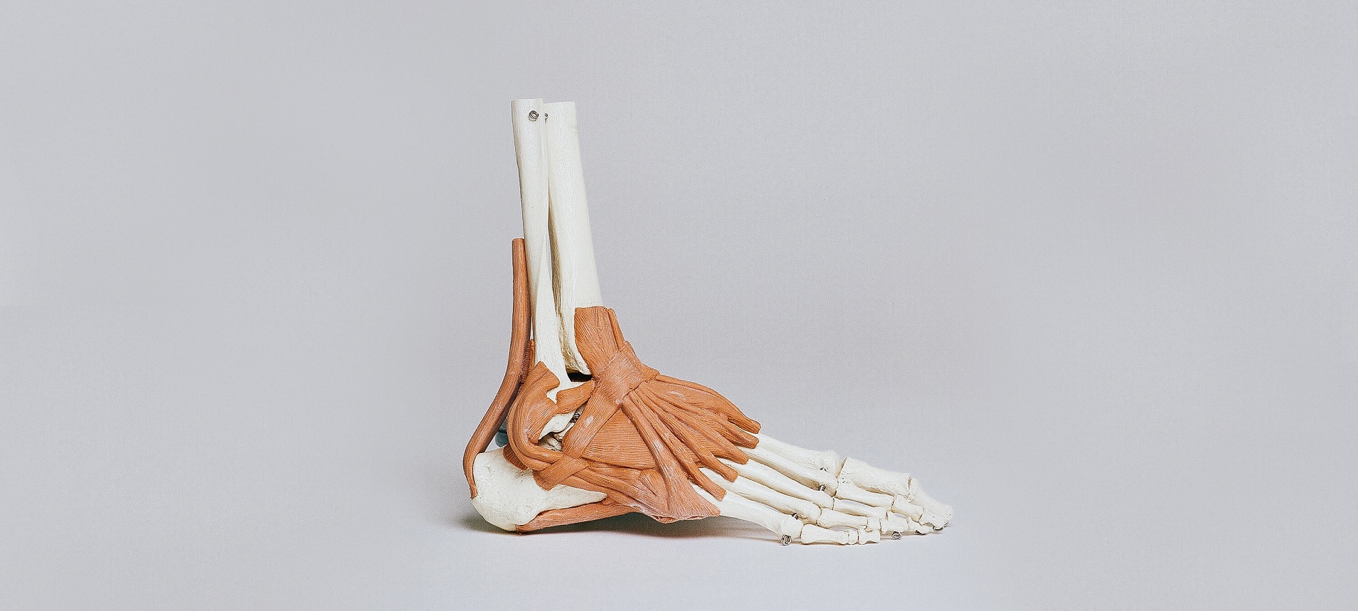 What is a Tarsal Coalition and how can it affect a Runner’s foot