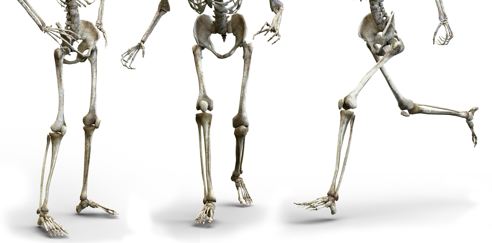 accessory navicular bone